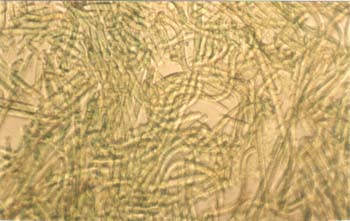 Tricomi tubi Marsciano