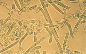 Tricomi1 tubi Marsciano