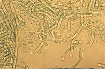 Tricomi2 tubi Marsciano