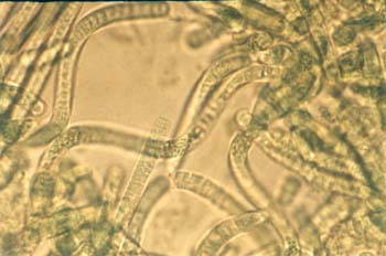 Tricomi3 tubi Marsciano